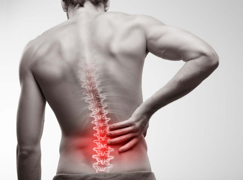 Low Back Pain Chiropractic San Jose CA